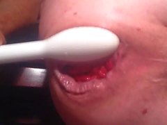 anus insérer de prolapsus cul bouche bée énorme con